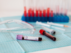 Two samples of blood in tests tubes laid down next to safety goggles in a laboratory with more test tubes in the background.