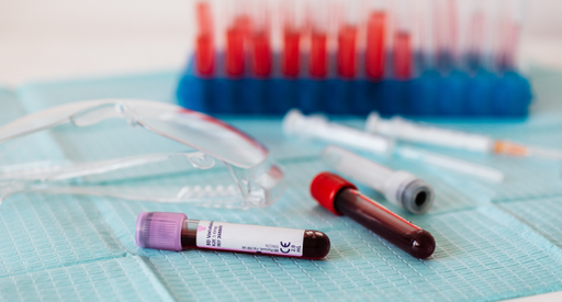Two samples of blood in tests tubes laid down next to safety goggles in a laboratory with more test tubes in the background.