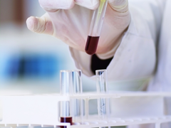 A close up of a researcher using a pipette inside a vial of blood cancer, in a rack with other vials of blood.
