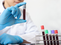 A blood cancer researcher lifts up a vial of blood from a rack of other vials of blood.