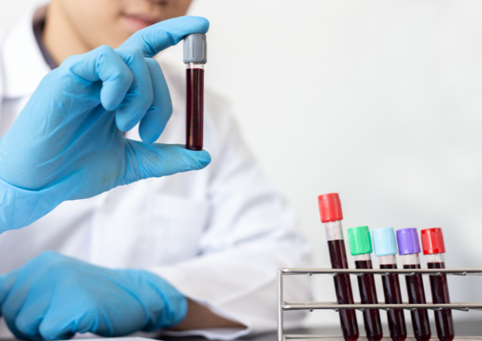 A blood cancer researcher lifts up a vial of blood from a rack of other vials of blood.