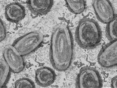 Abstract representation of Monkeypox virus down a microscope.