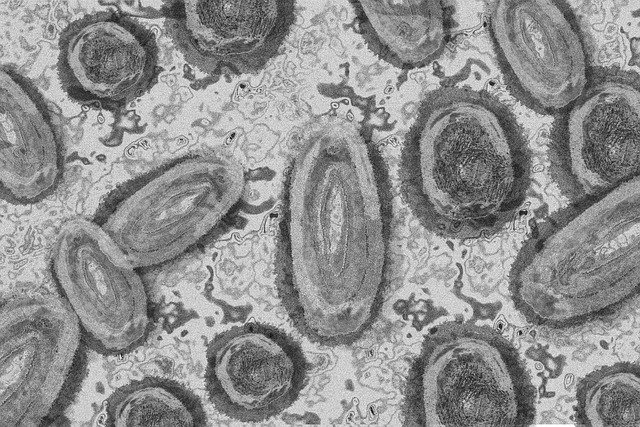 Abstract representation of Monkeypox virus down a microscope.