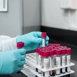 A researcher puts test tubes containing blood into a rack