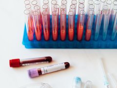 A close up of test tubes filled with blood stood upright in a tray.