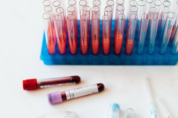 A close up of test tubes filled with blood stood upright in a tray.