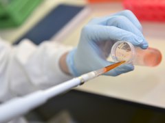 A close up of a pipette in a test tube filled with blood in a laboratory.