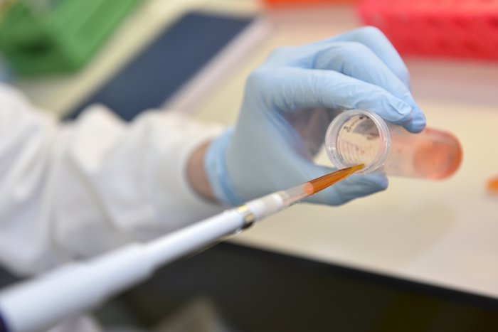 A close up of a pipette in a test tube filled with blood in a laboratory.
